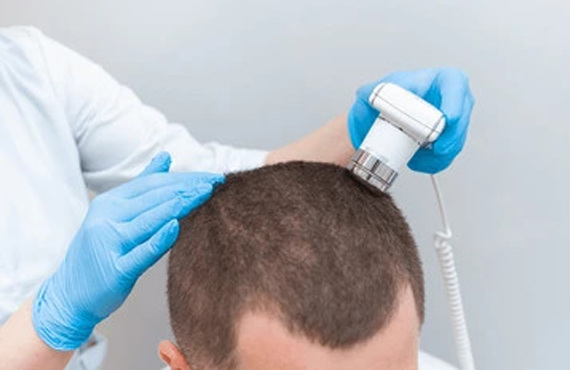 Best Hair Transplant Surgery Doctors in Chennai Hair Transplants Doctors in Guindy, Chennai