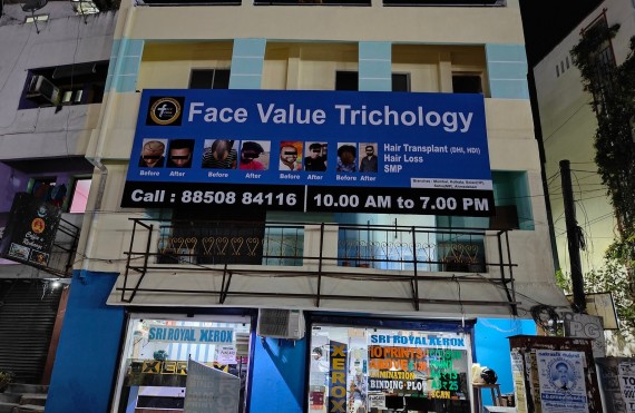 Hair Replacement Clinic in Mylapore